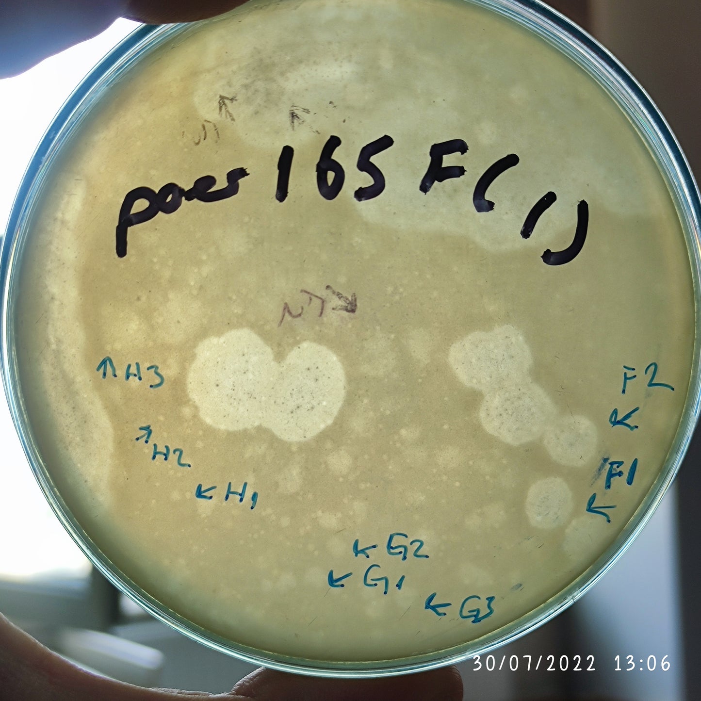 Pseudomonas aeruginosa bacteriophage 130165F