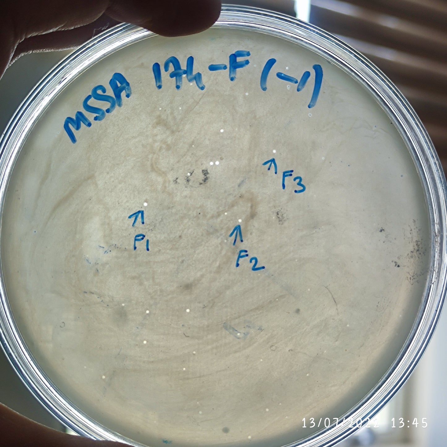 Staphylococcus aureus bacteriophage 152174F