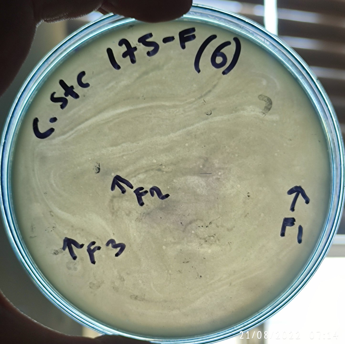 Corynebacterium striatum bacteriophage 200175F