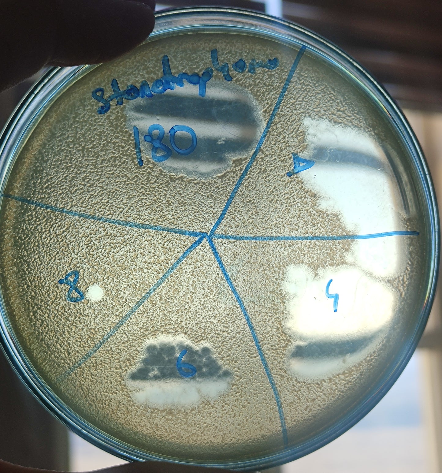 Stenotrophomonas maltophilia bacteriophage 200180D