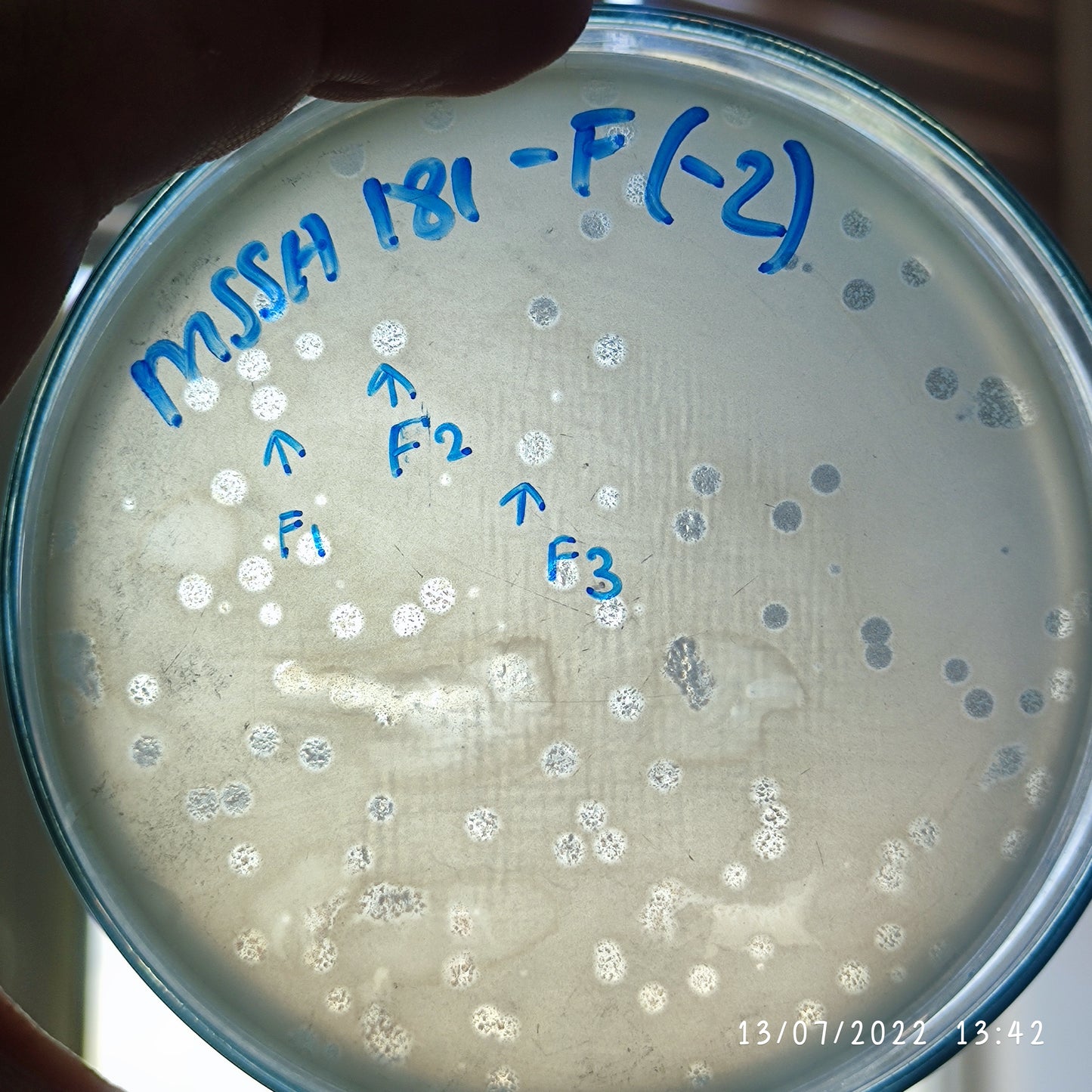 Staphylococcus aureus bacteriophage 152181F