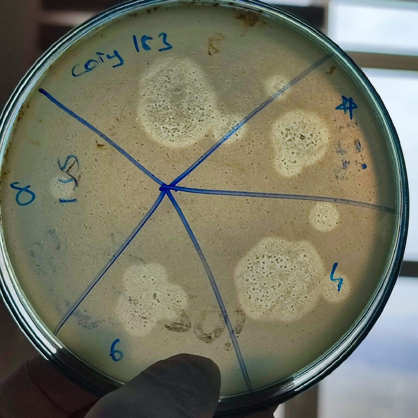 Corynebacterium striatum bacteriophage 200183D