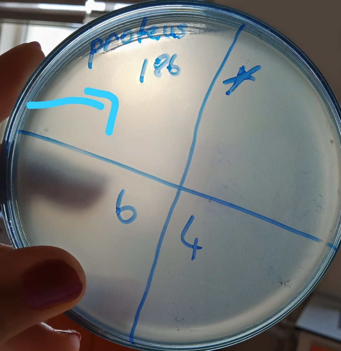 Proteus mirabilis bacteriophage 200186A