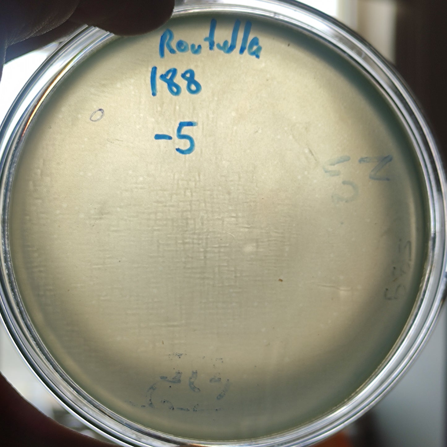 Raoultella ornithinolytica bacteriophage 200188D