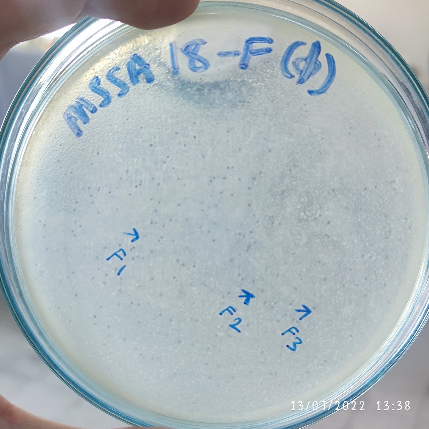 Staphylococcus aureus bacteriophage 152018F