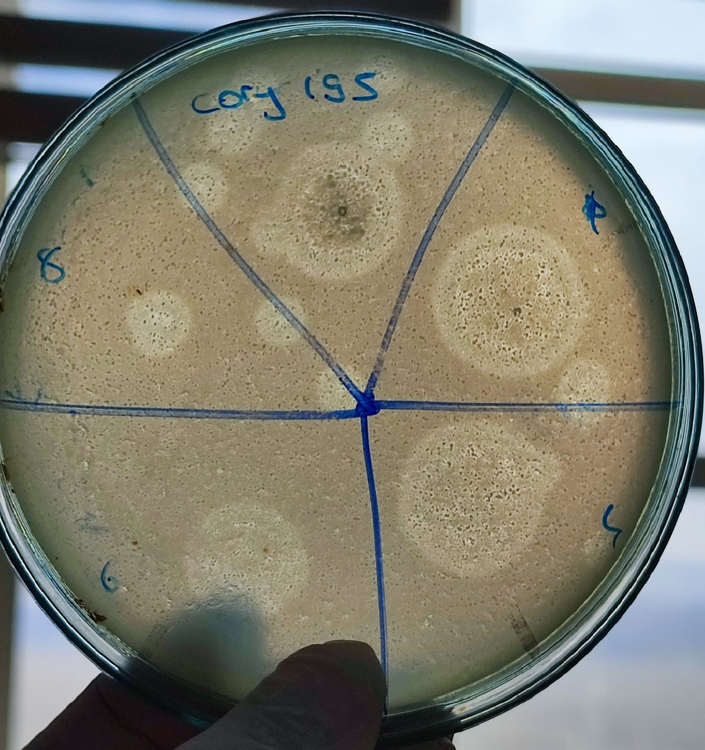 Corynebacterium striatum bacteriophage 200195D