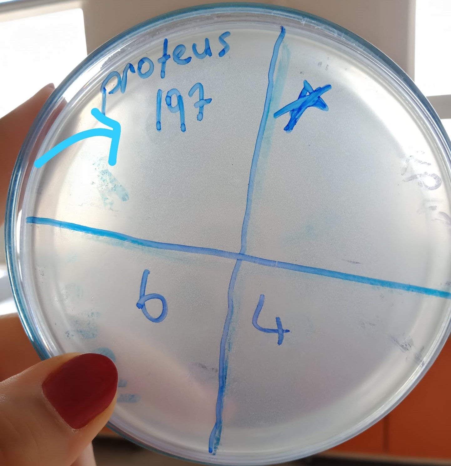 Proteus mirabilis bacteriophage 200197A