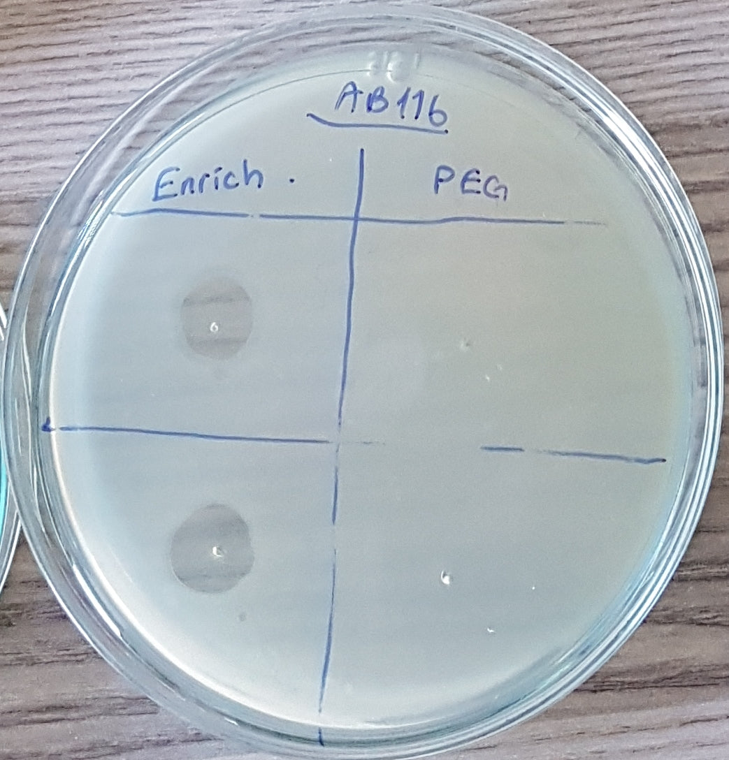 Acinetobacter baumannii bacteriophage 120116B