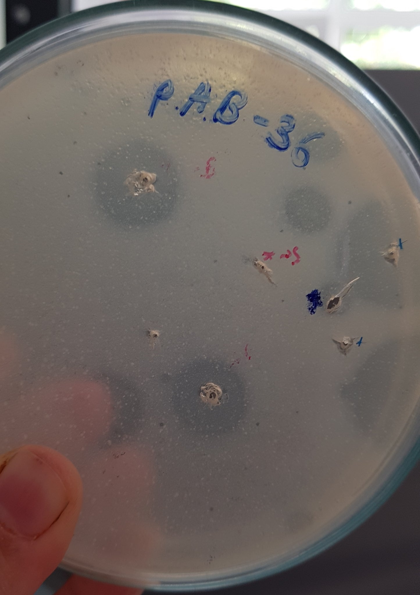 Acinetobacter baumannii bacteriophage 120036A