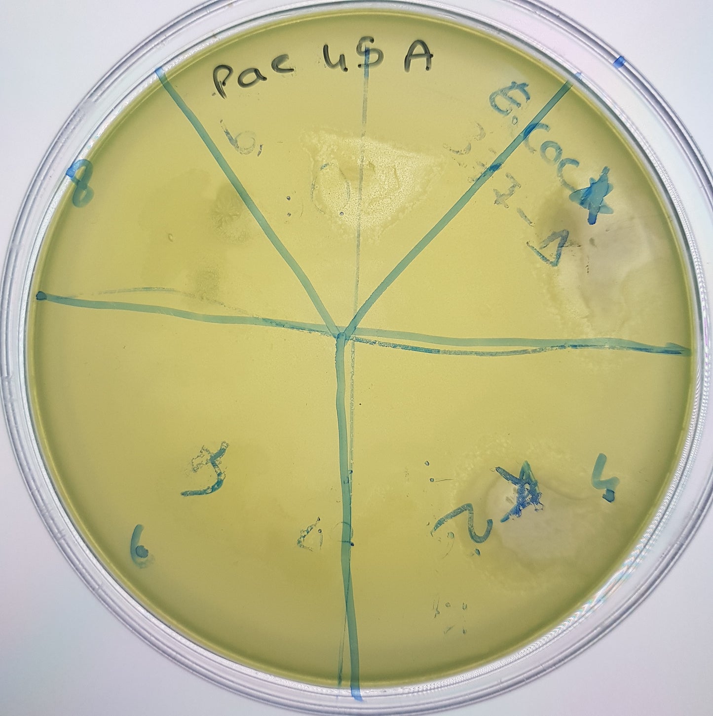 Pseudomonas aeruginosa bacteriophage 130045A