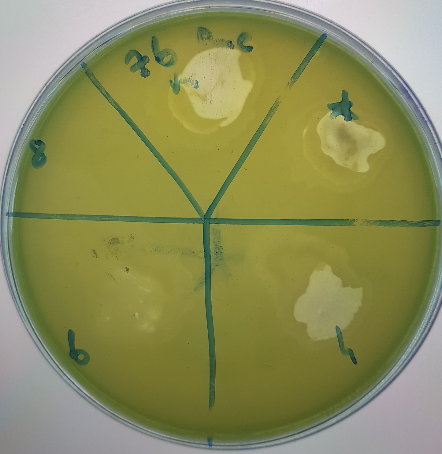Pseudomonas aeruginosa bacteriophage 130076A