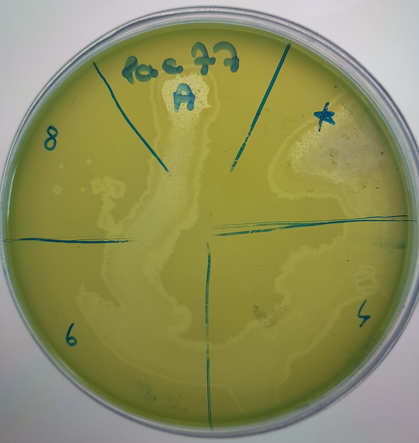 Pseudomonas aeruginosa bacteriophage 130077A