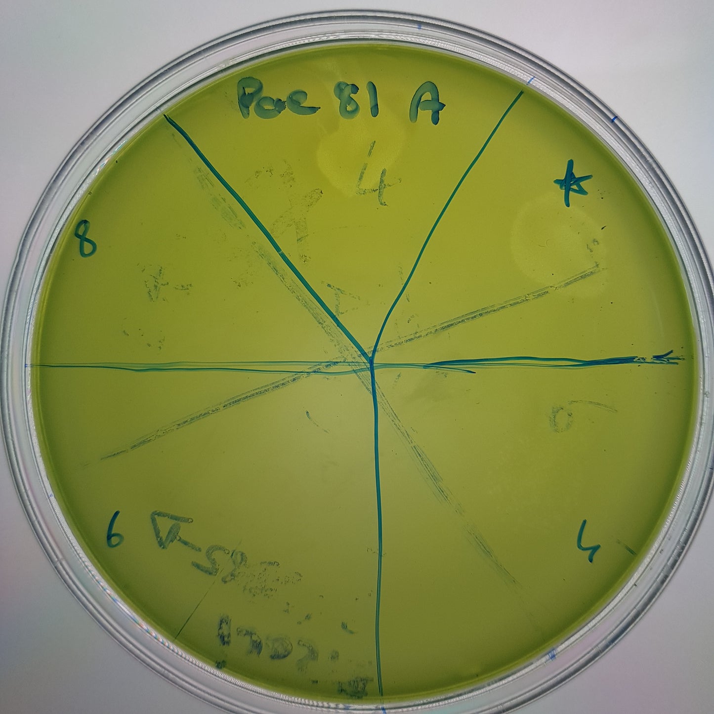 Pseudomonas aeruginosa bacteriophage 130081A