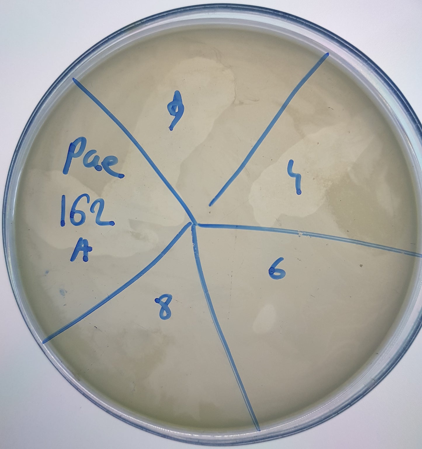 Pseudomonas aeruginosa bacteriophage 130162A