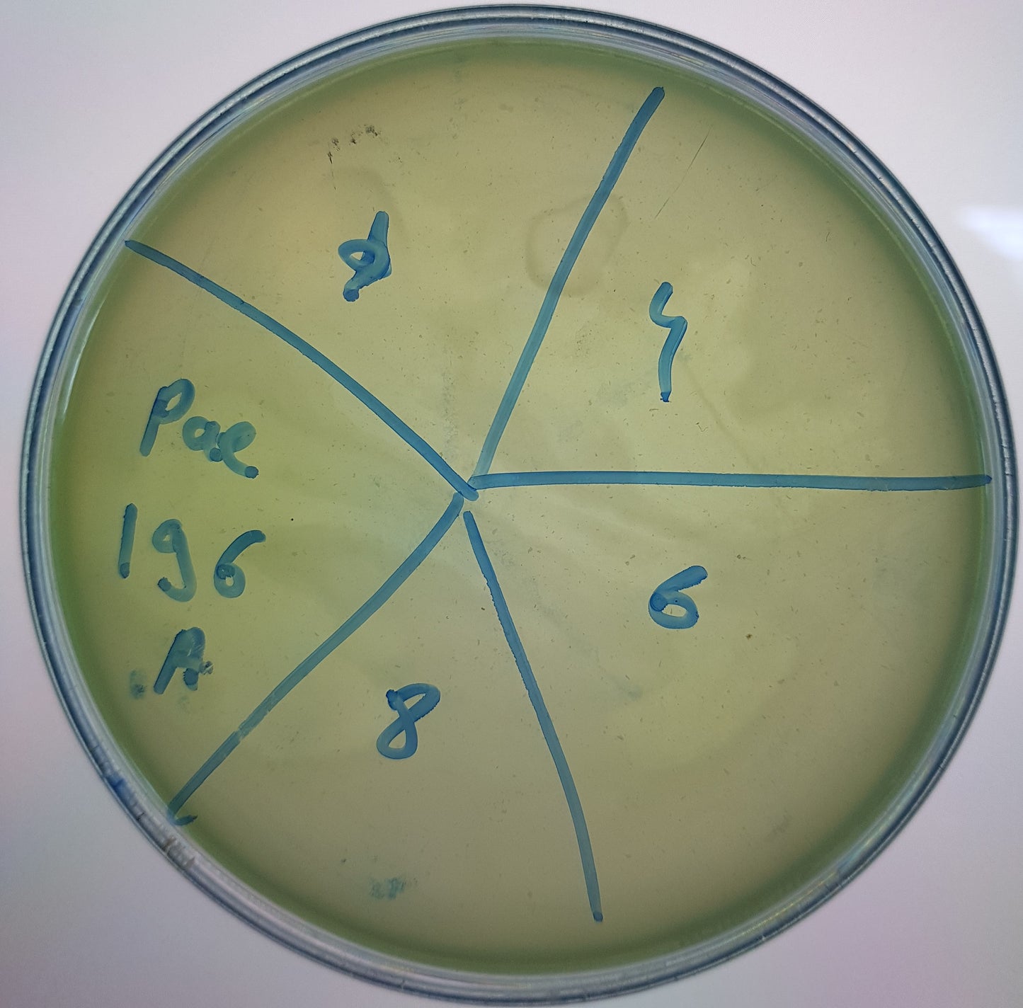 Pseudomonas aeruginosa bacteriophage 130196A