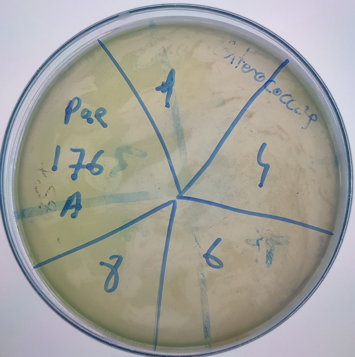 Pseudomonas aeruginosa bacteriophage 130176A