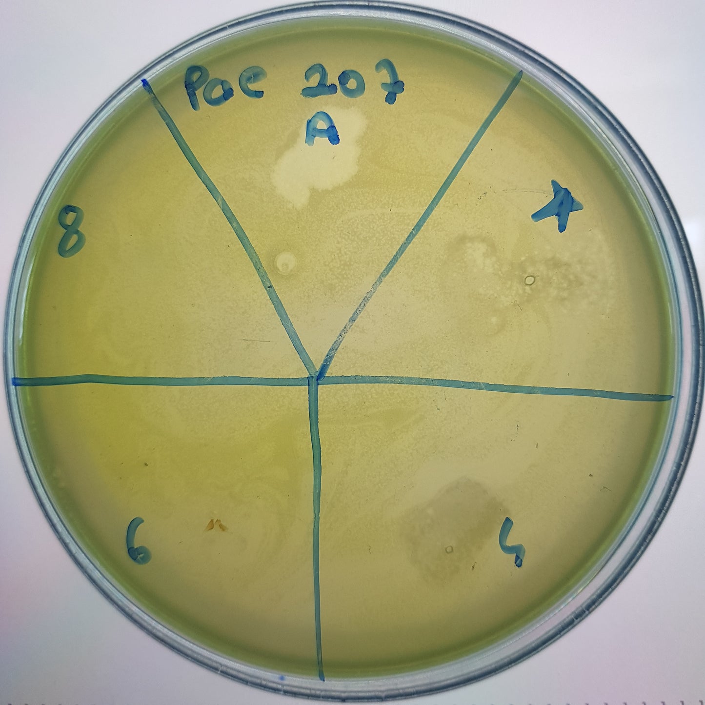 Pseudomonas aeruginosa bacteriophage 130207A