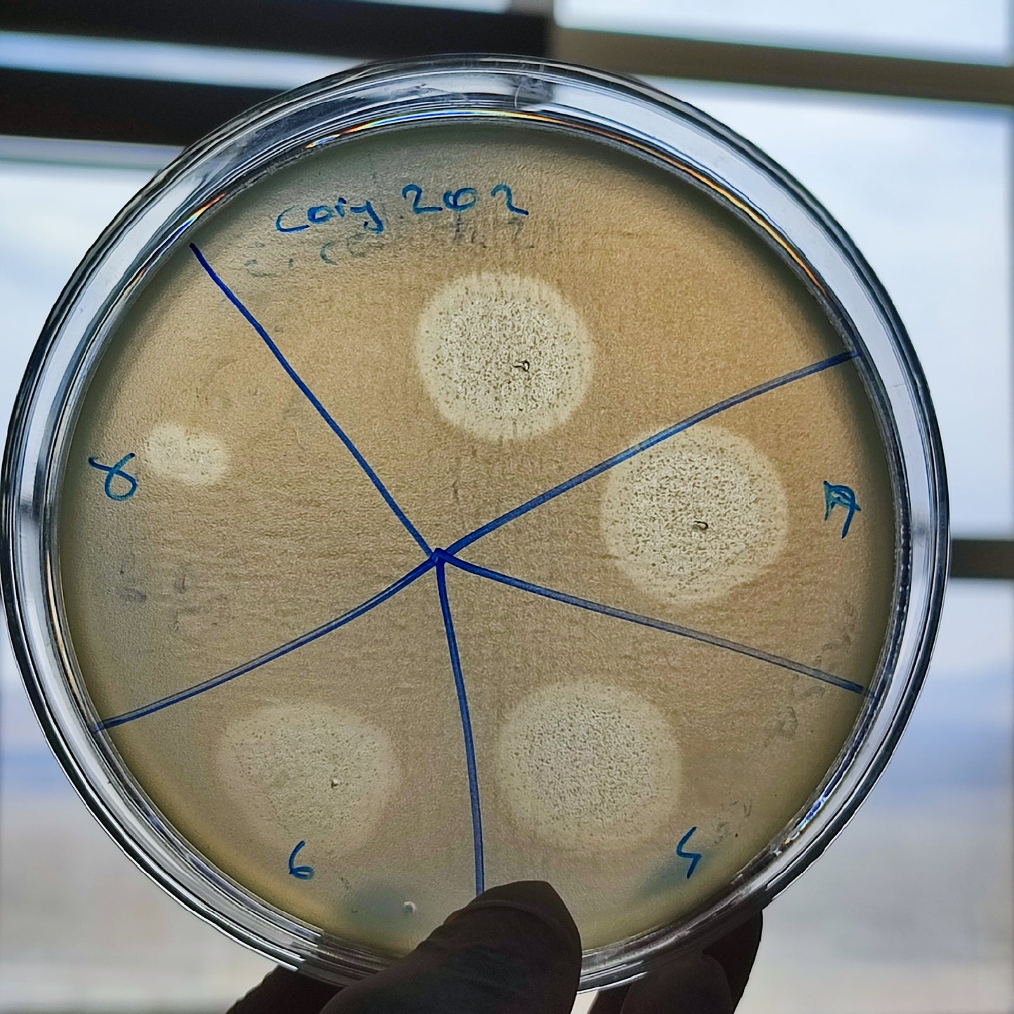 Corynebacterium striatum bacteriophage 200202D