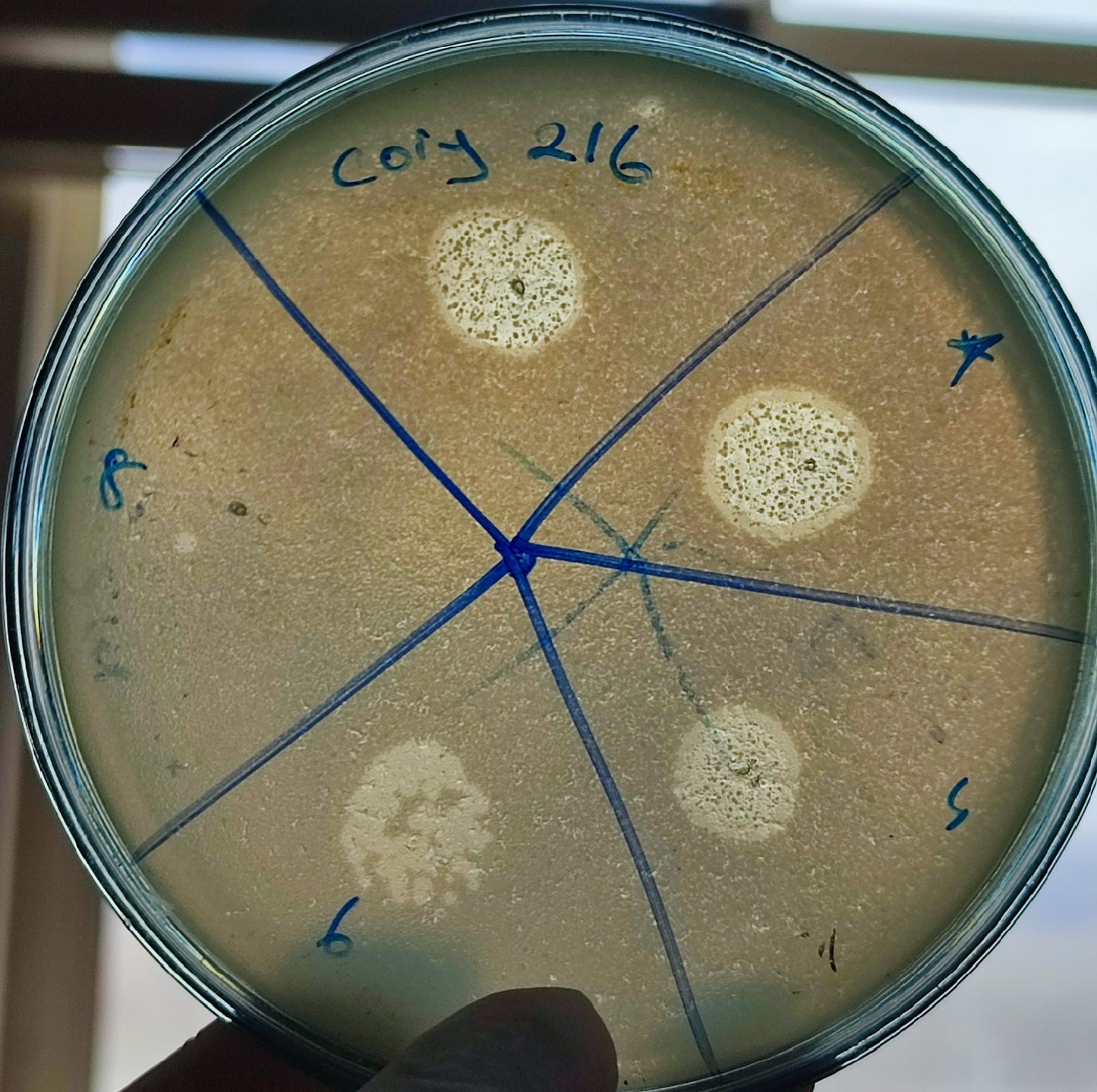Corynebacterium striatum bacteriophage 200216D