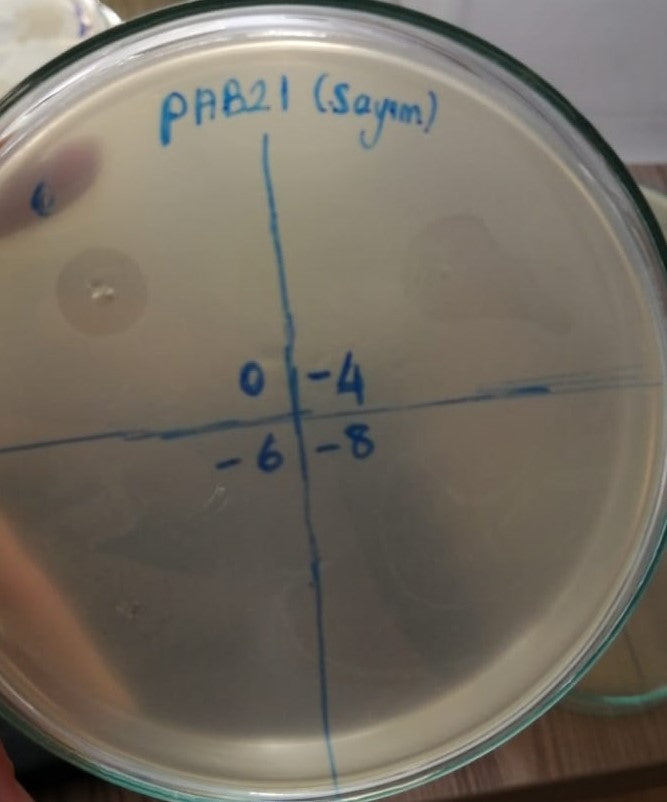 Acinetobacter baumannii bacteriophage 120021A
