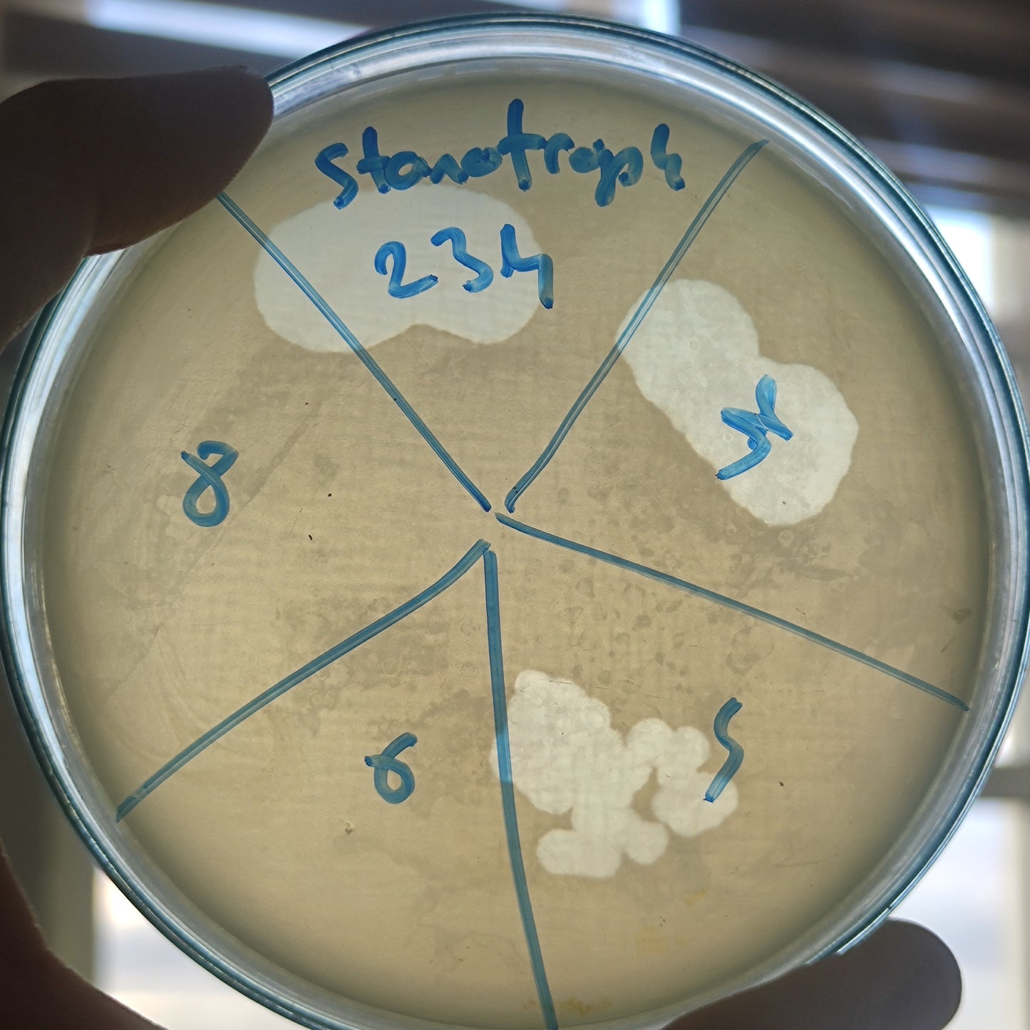 Stenotrophomonas maltophilia bacteriophage 200234D
