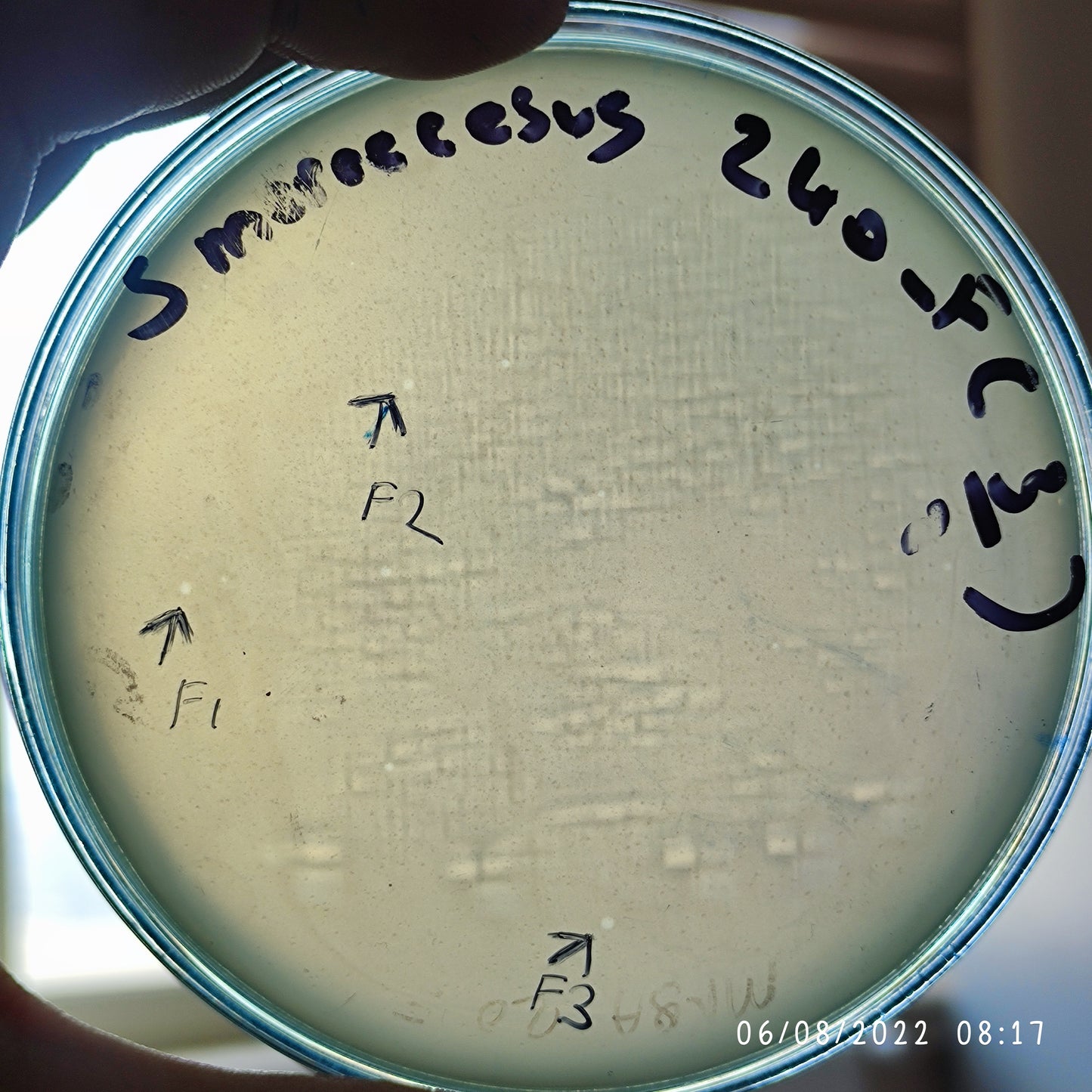 Serratia marcescens bacteriophage 200240F