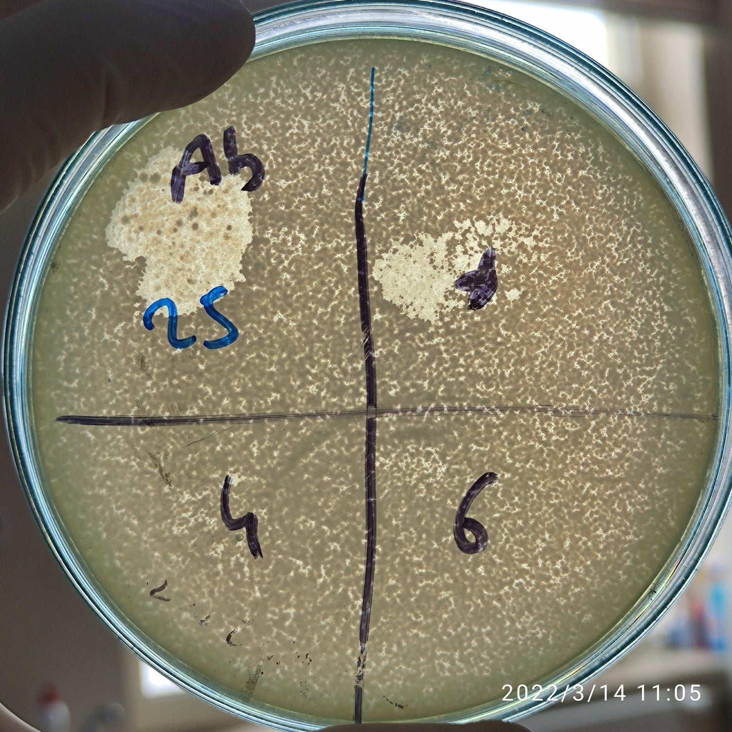 Acinetobacter baumannii bacteriophage 120025D