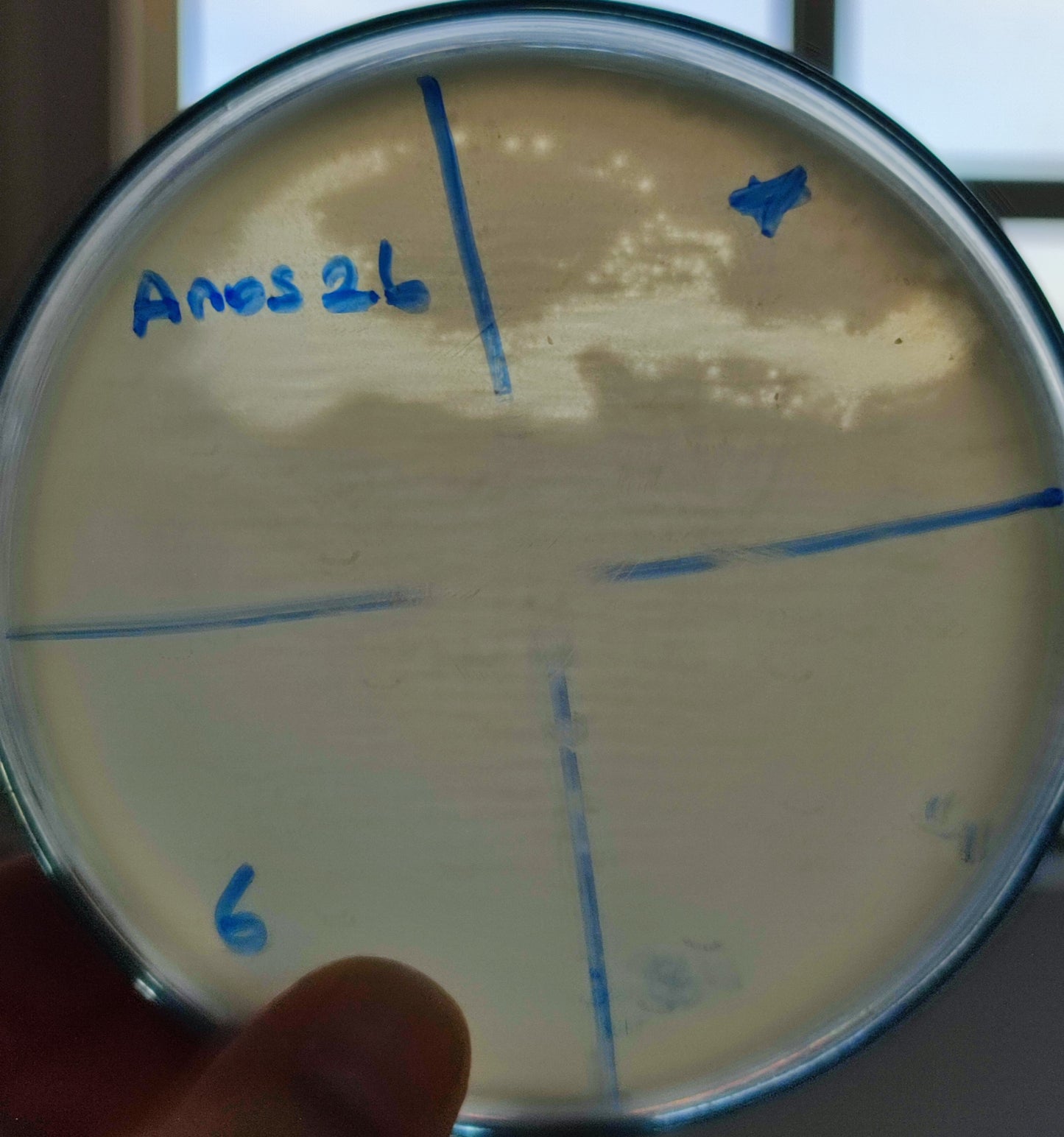 Acinetobacter nosocomialis bacteriophage 128026D
