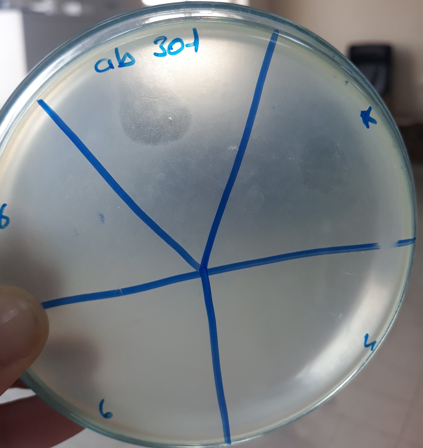 Acinetobacter baumannii bacteriophage 120301A