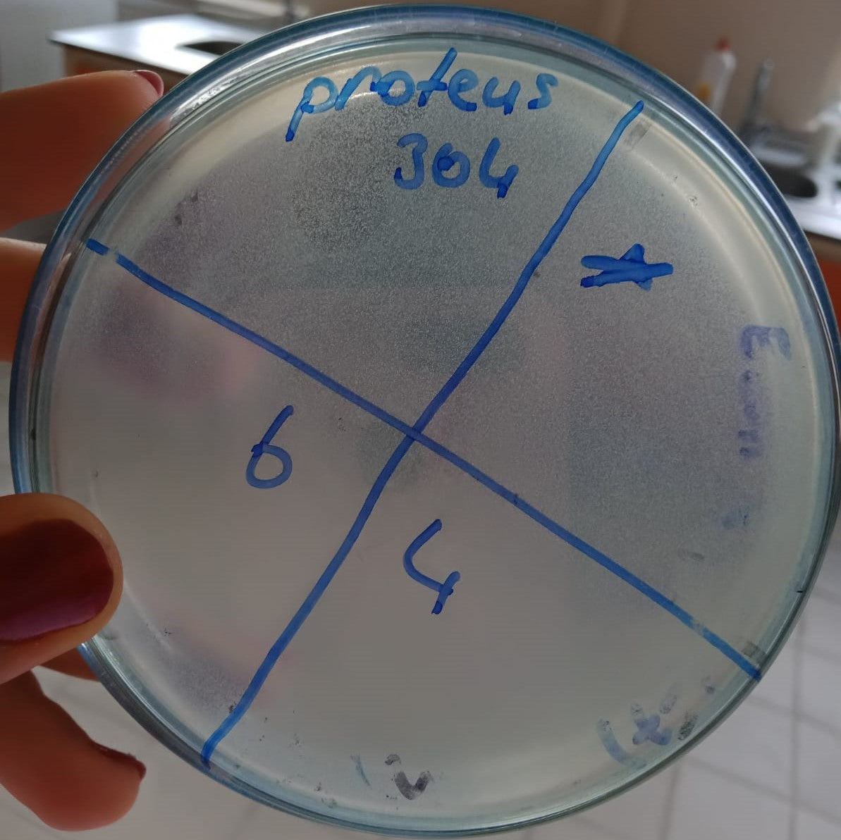 Proteus mirabilis bacteriophage 200304A