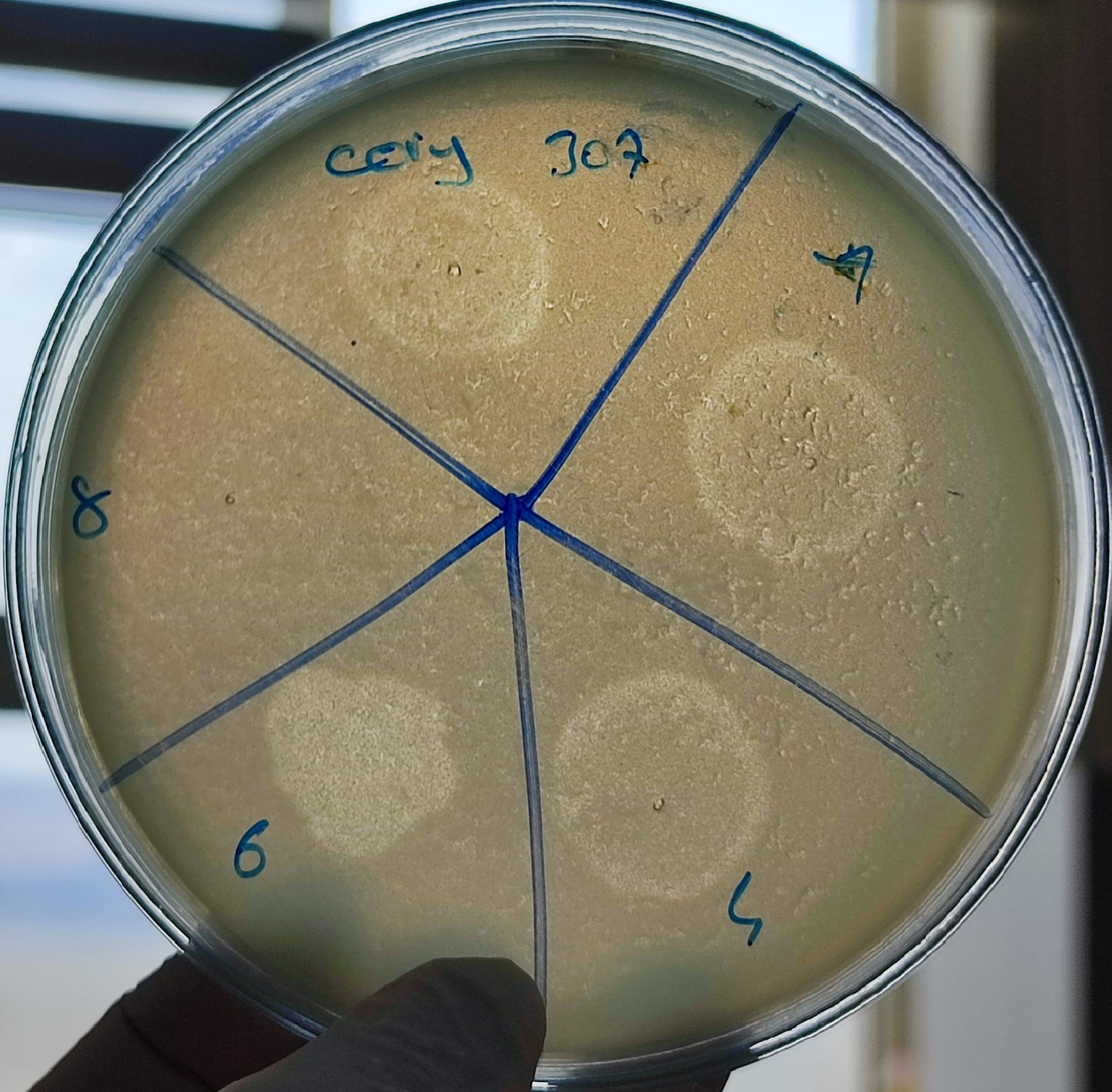 Corynebacterium striatum bacteriophage 200307D