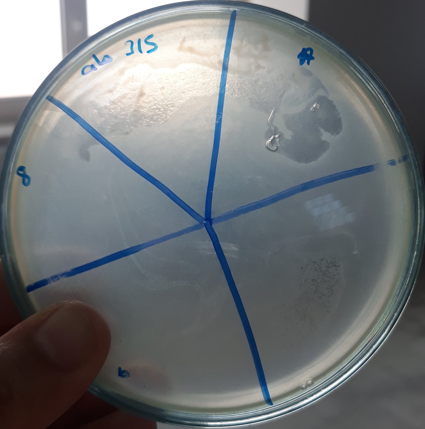 Acinetobacter baumannii bacteriophage 120315A