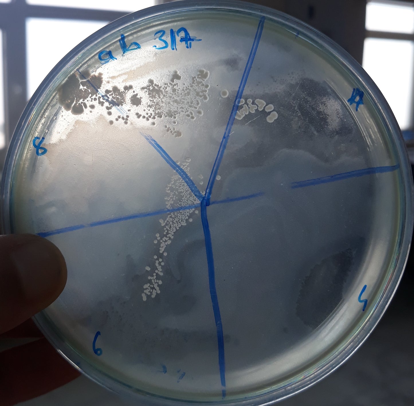 Acinetobacter baumannii bacteriophage 120317A