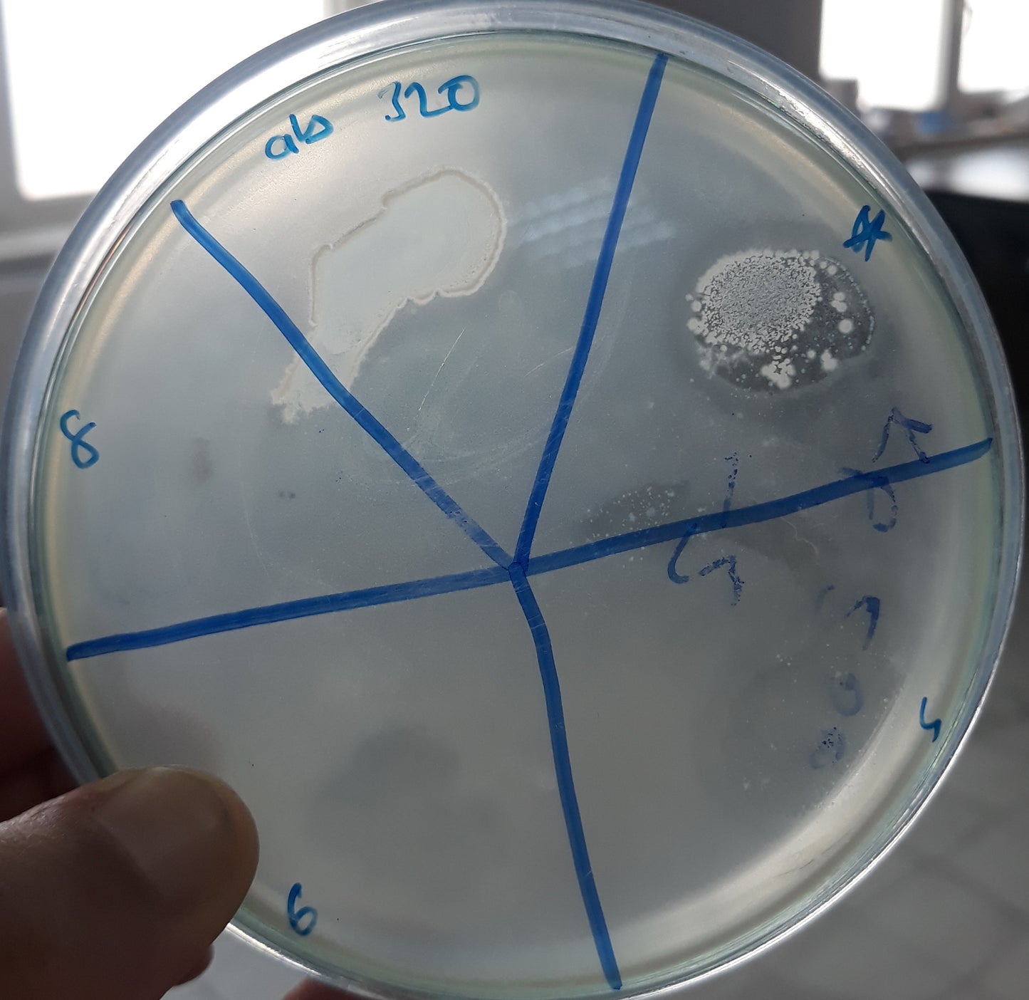 Acinetobacter baumannii bacteriophage 120320A