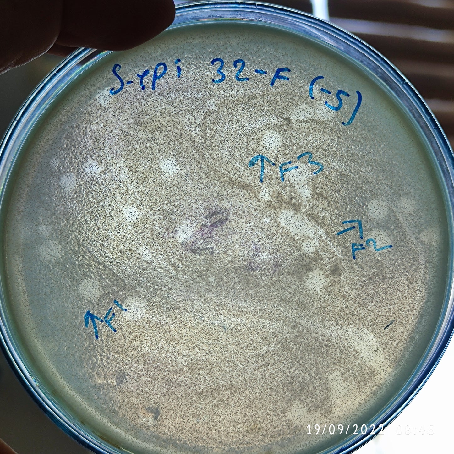 Staphylococcus epidermidis bacteriophage 158032F