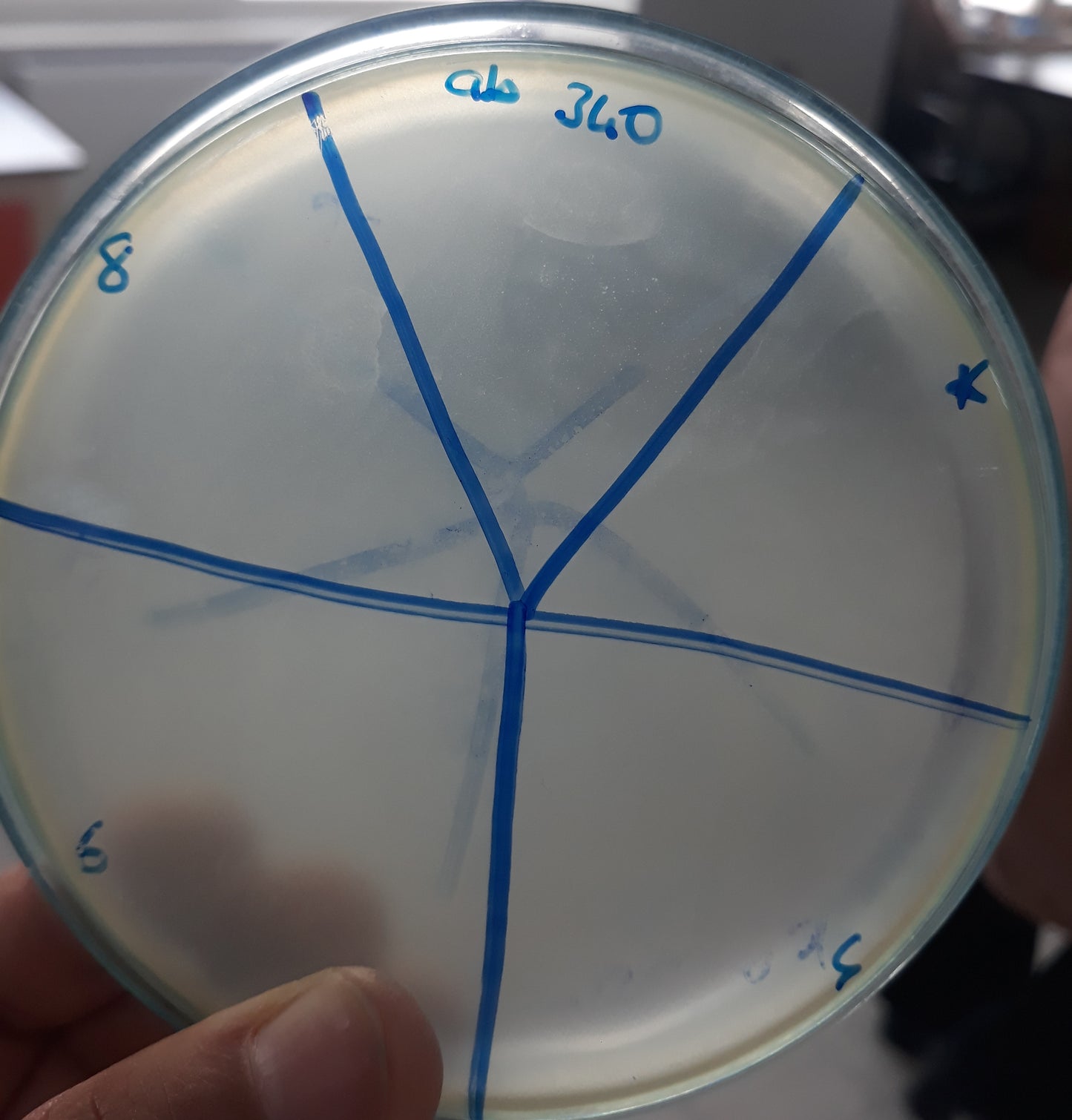 Acinetobacter baumannii bacteriophage 120340A