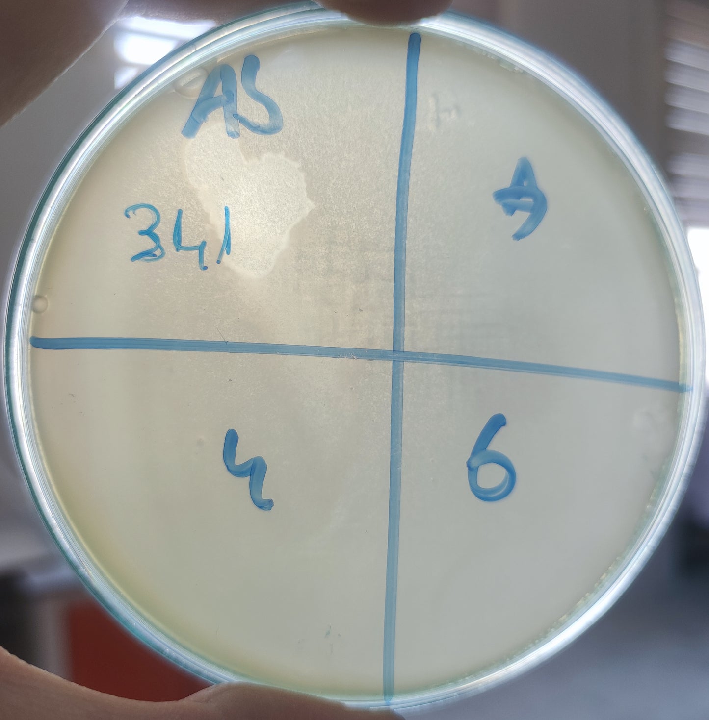 Acinetobacter baumannii bacteriophage 120341A