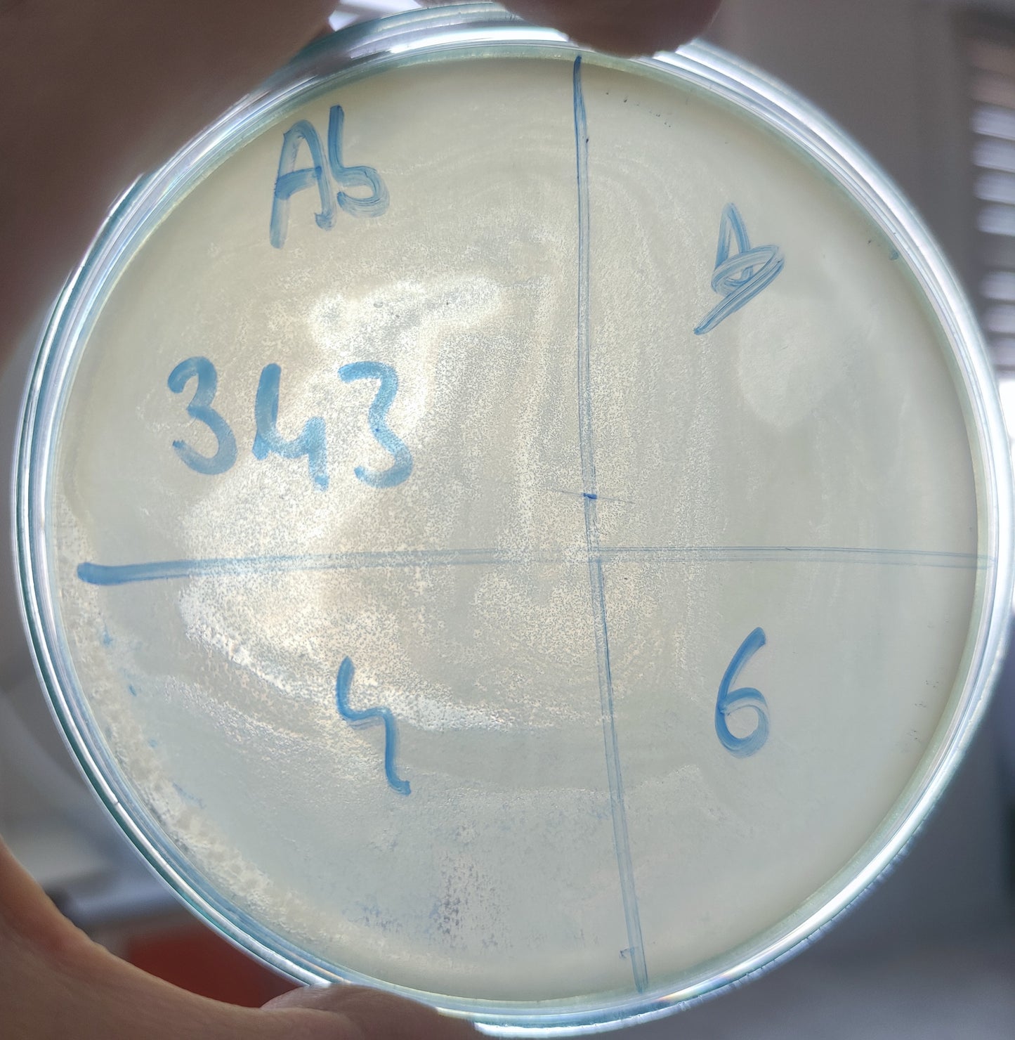 Acinetobacter baumannii bacteriophage 120343A