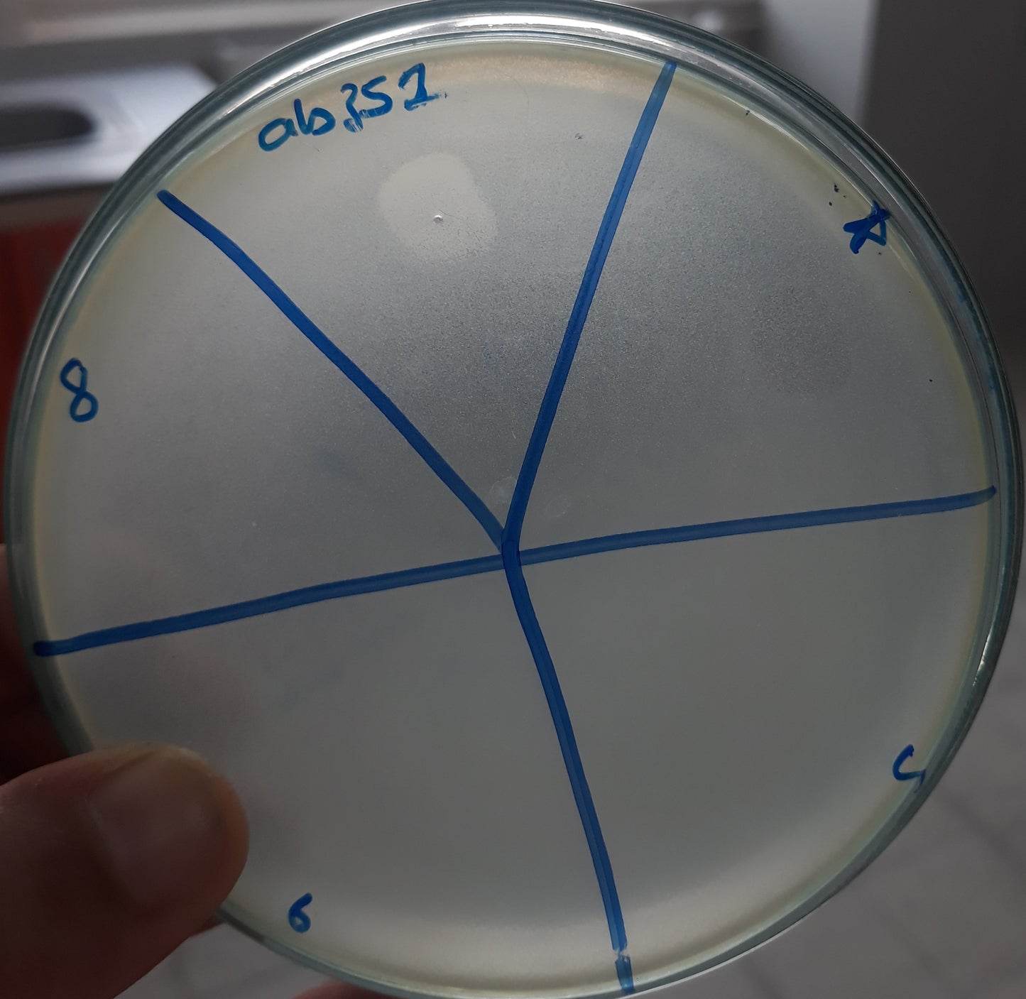 Acinetobacter baumannii bacteriophage 120352A