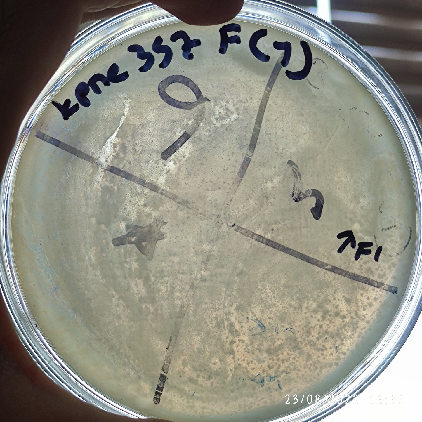 Klebsiella pneumoniae bacteriophage 180357F