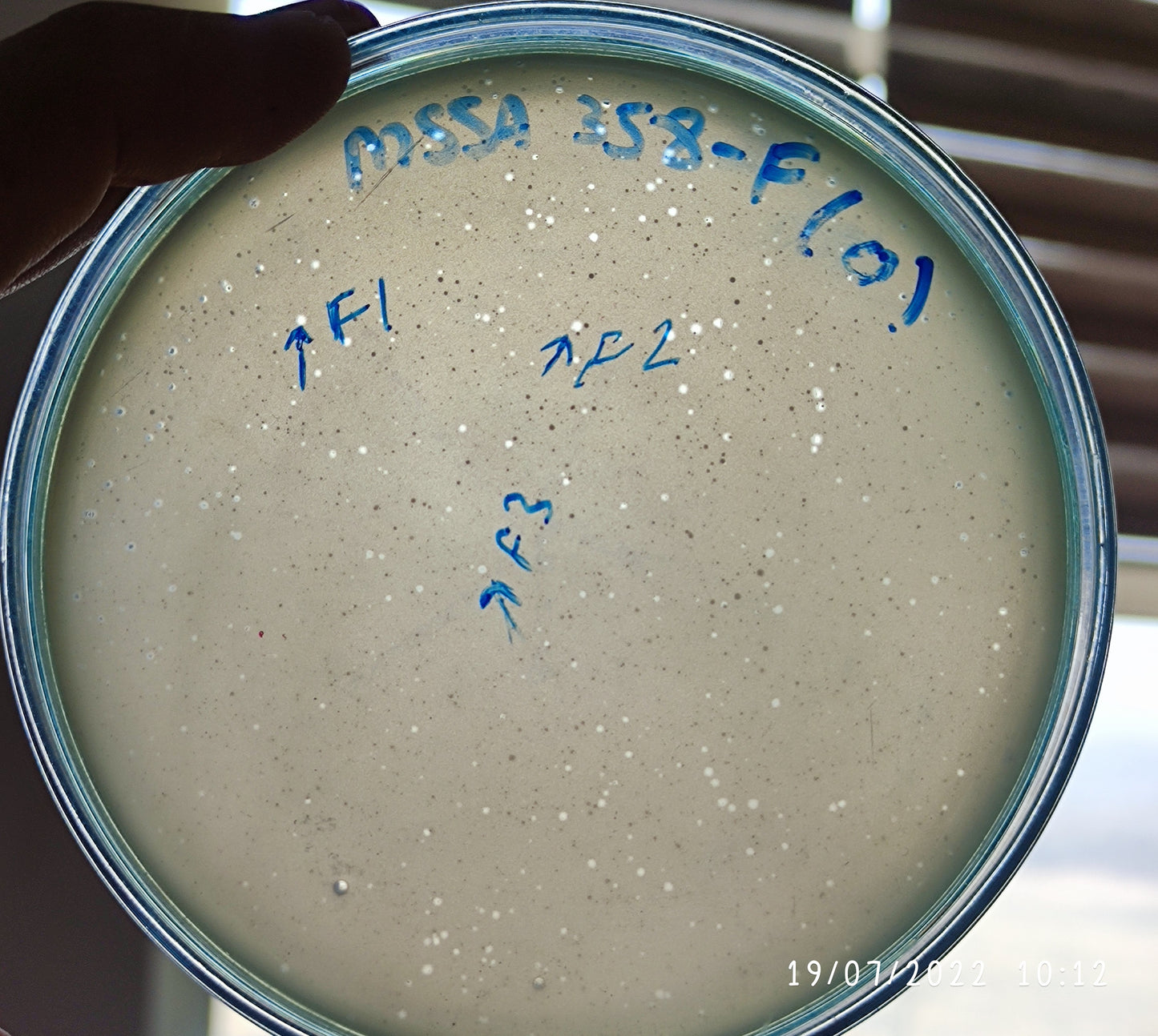 Staphylococcus aureus bacteriophage 152358F
