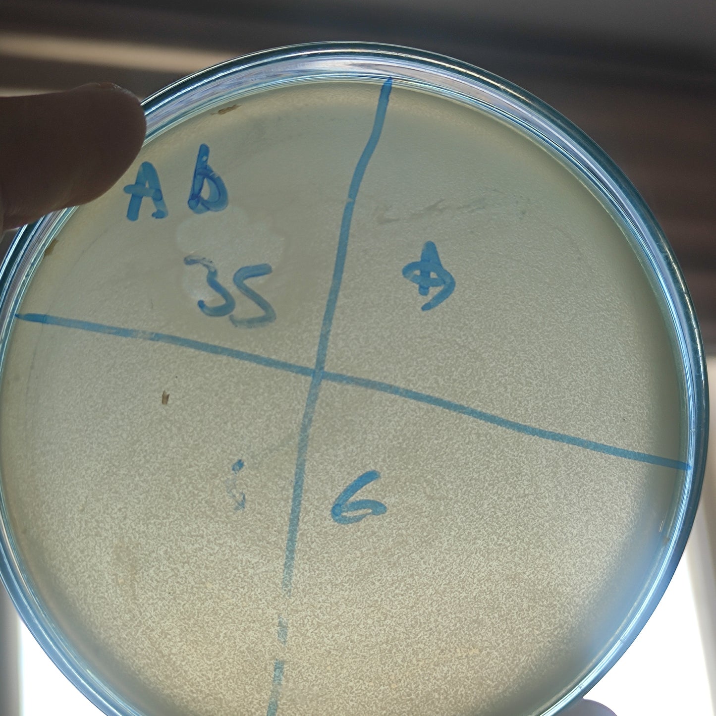 Acinetobacter baumannii bacteriophage 120035D