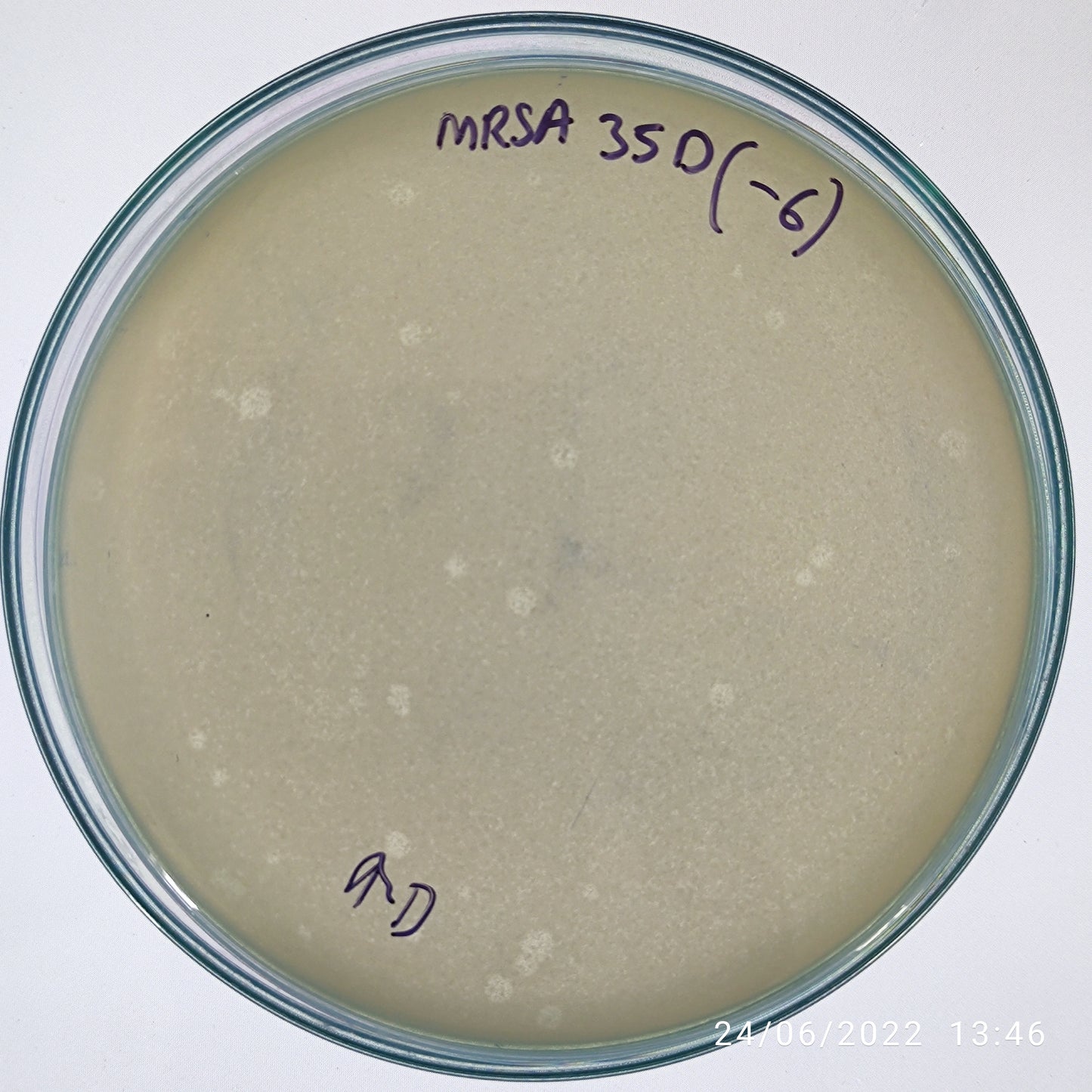 Staphylococcus aureus bacteriophage 150035D