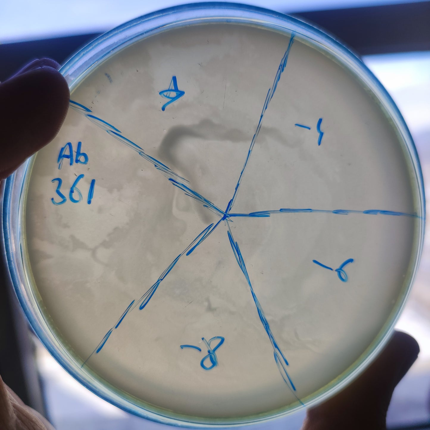 Acinetobacter baumannii bacteriophage 120361A