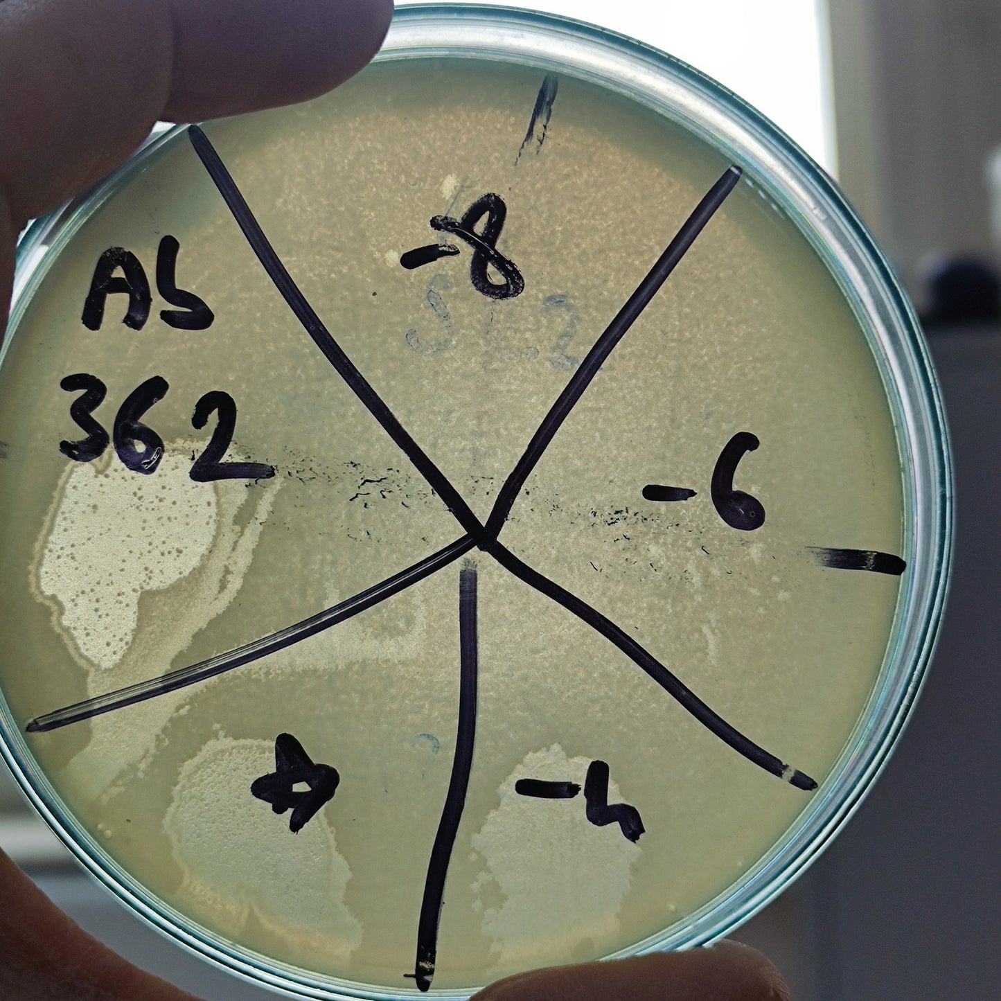 Acinetobacter baumannii bacteriophage 120362A