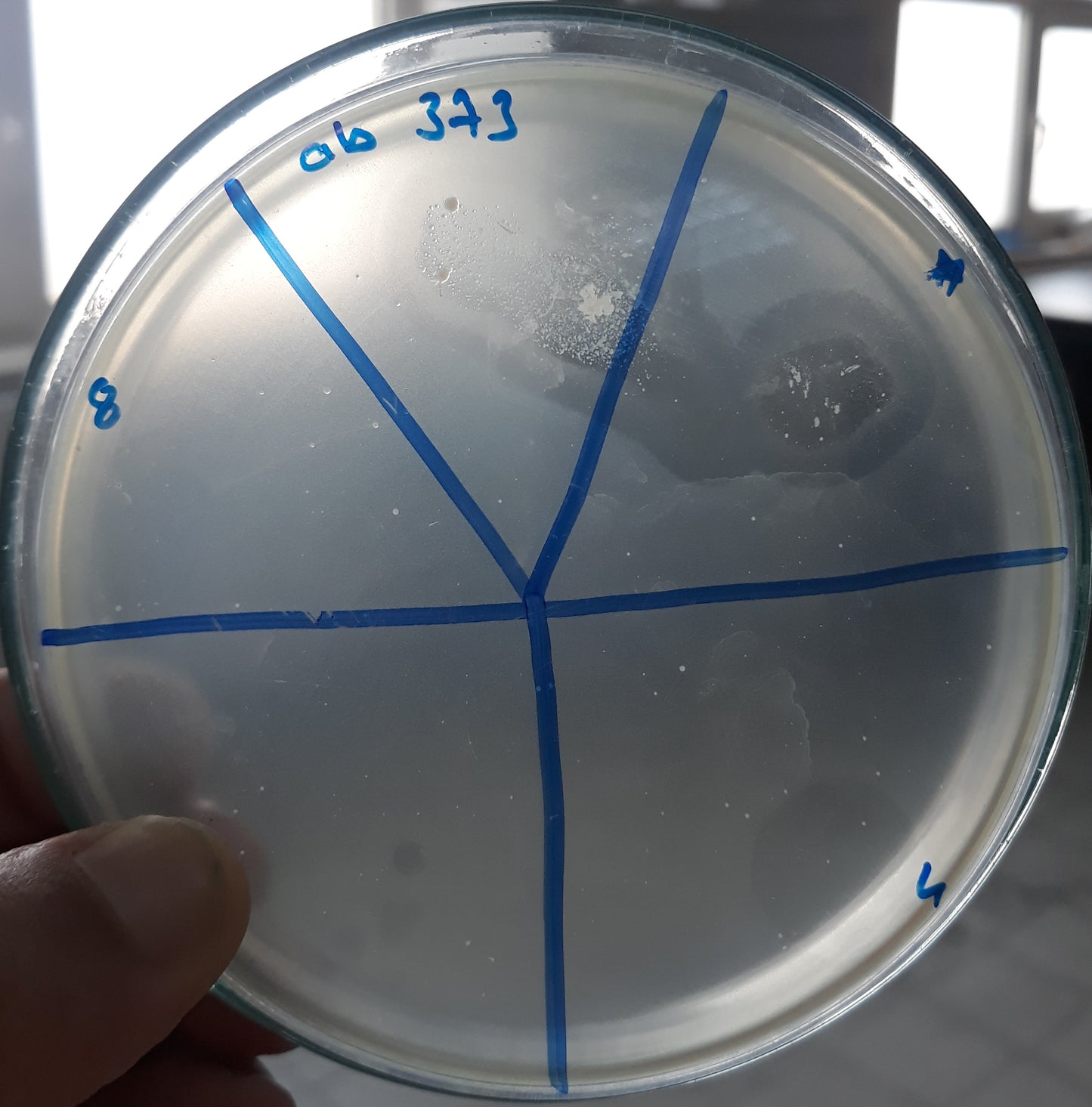 Acinetobacter baumannii bacteriophage 120373A