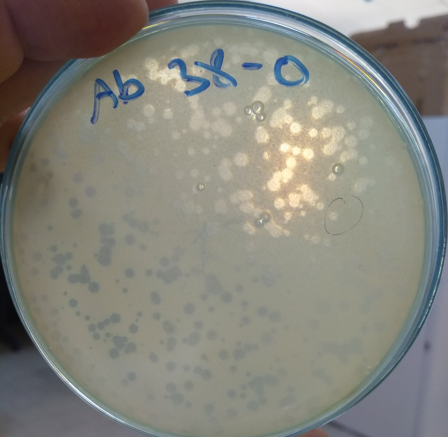 Acinetobacter baumannii bacteriophage 120038A