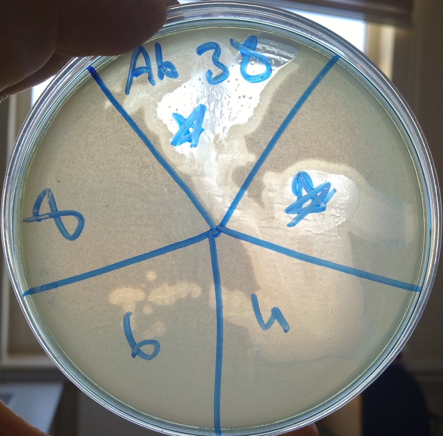 Acinetobacter baumannii bacteriophage 120038A
