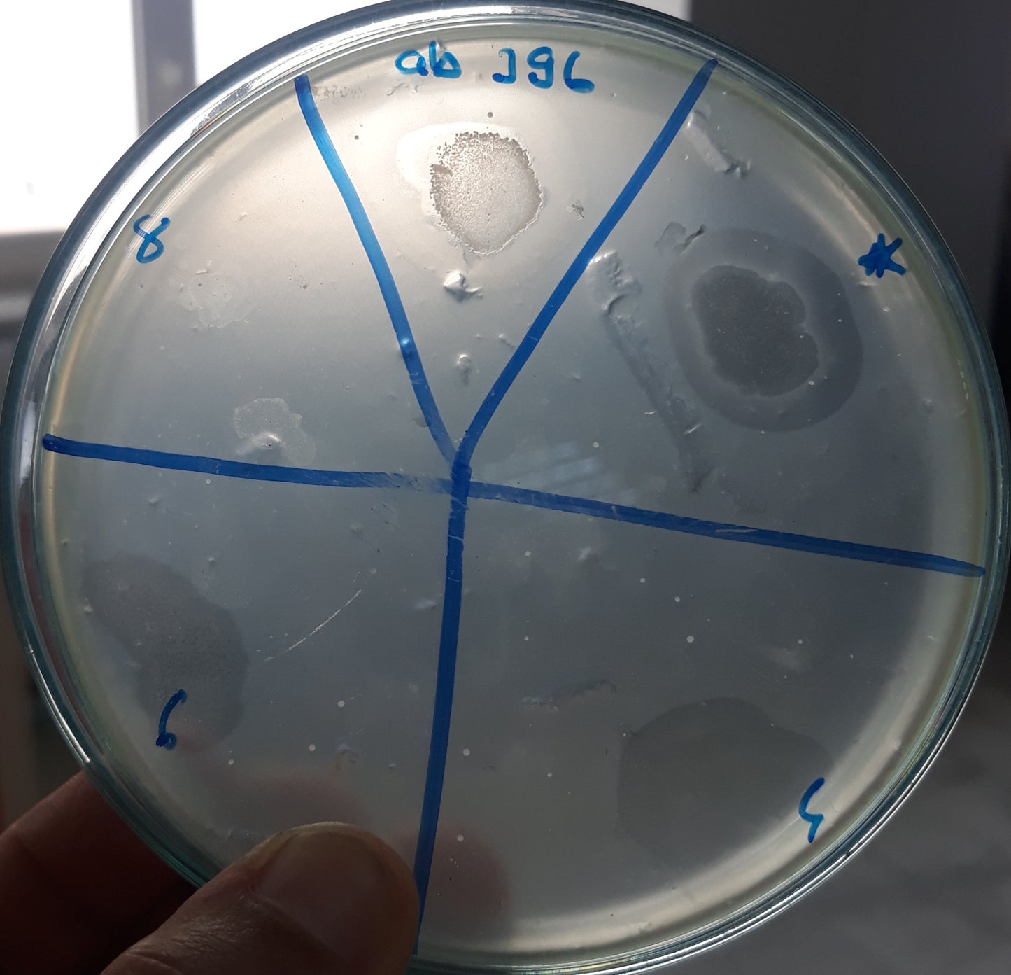 Acinetobacter baumannii bacteriophage 120396A