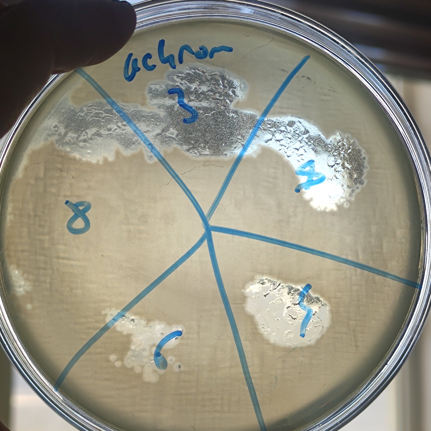 Achromobacter xylosoxidans bacteriophage 200003D